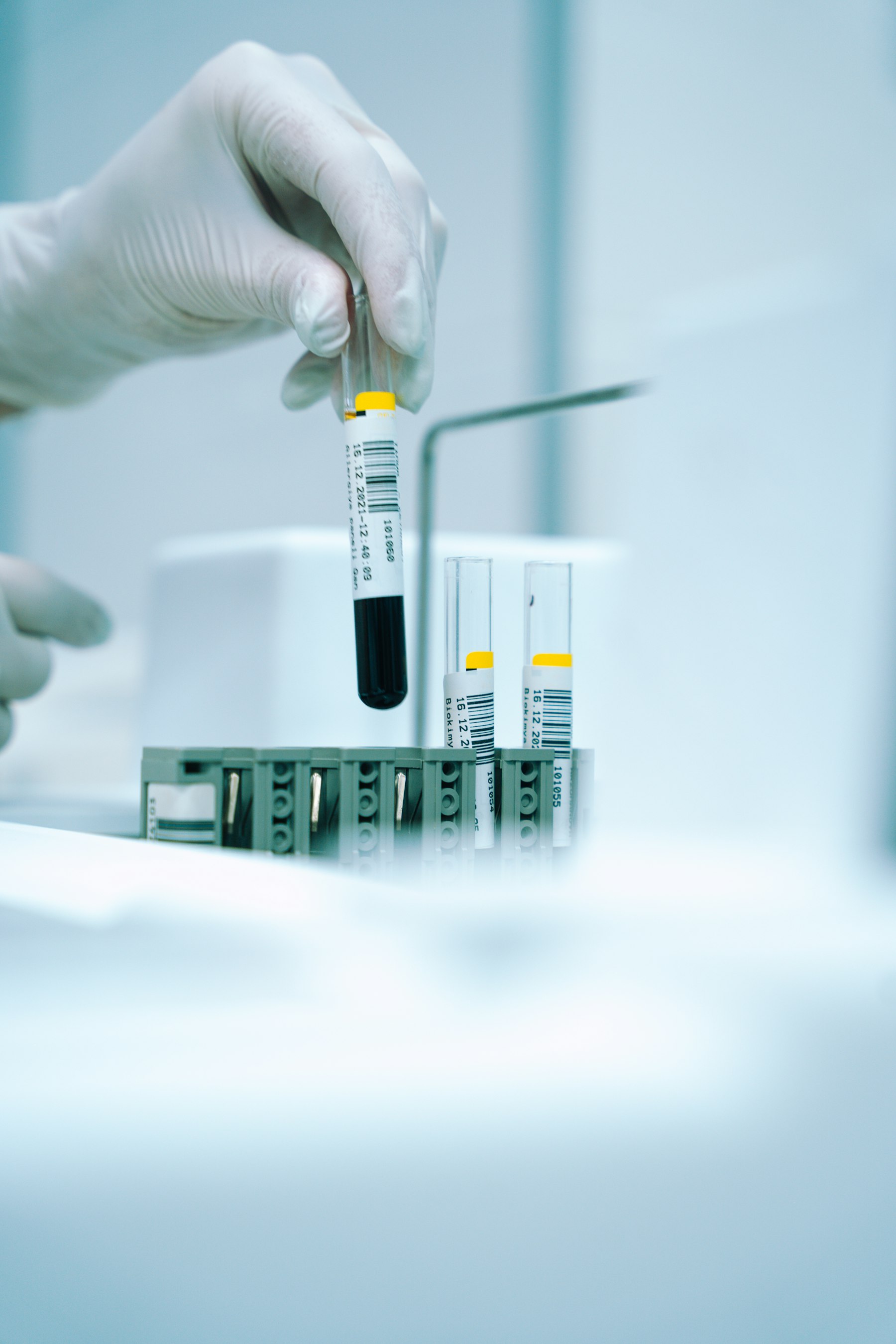 Gloved hand holding a blood sample test tube in a laboratory